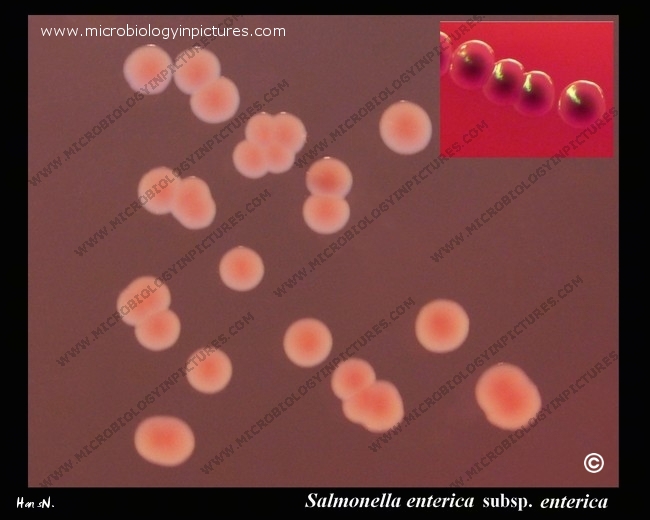salmonella colonies on Endo